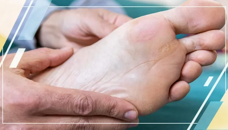 Diabetic Foot Ulcer DFU Treatment